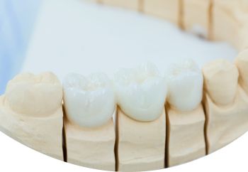 Условно-съемное протезирование зубов